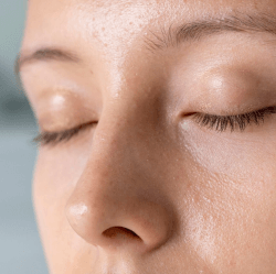 open_pores
