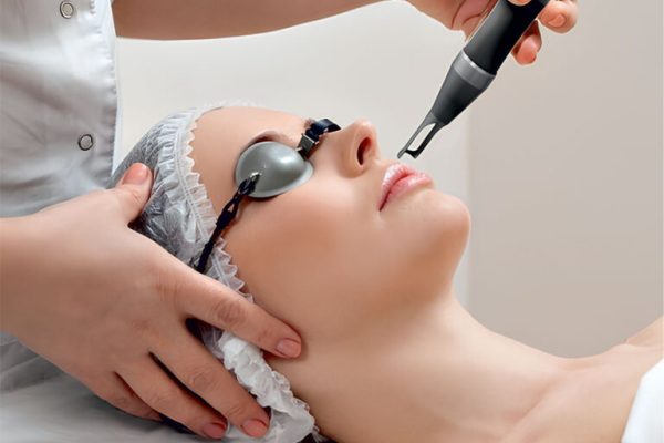 Lasers Treatments
