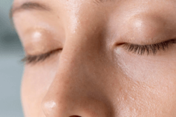 open_pores