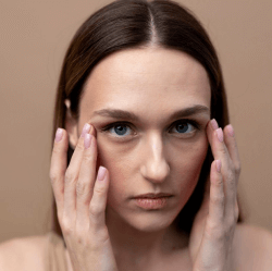 dark_circles