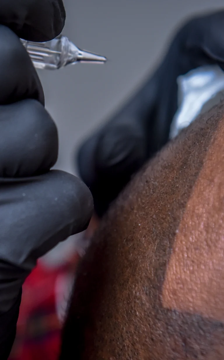 scalp_mircropigmentation-768x1232